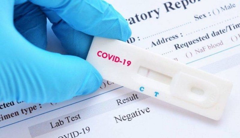 كوريا الجنوبية تسجل 84 128 إصابة بفيروس كورونا