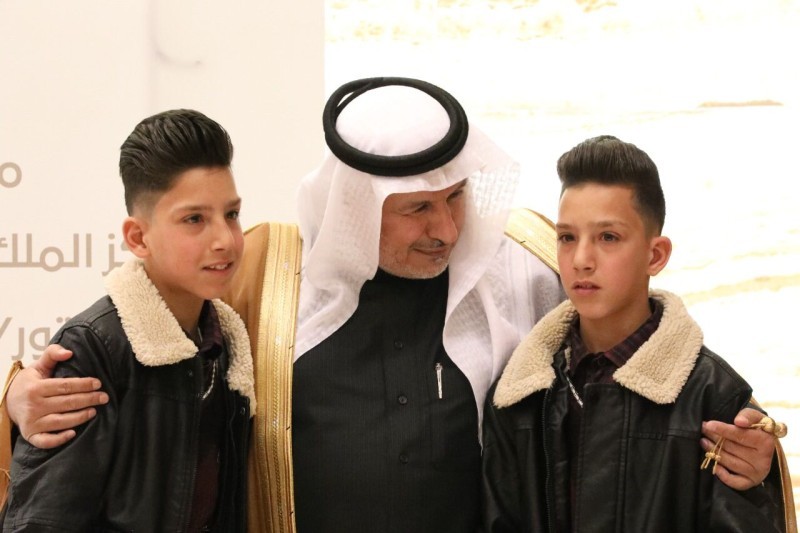 التوأم السيامي الأردني محمد وأمجد