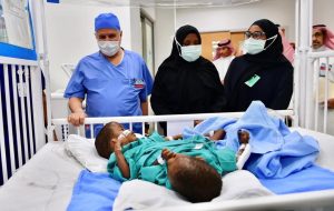 عملية فصل التوأم السيامي التنزاني