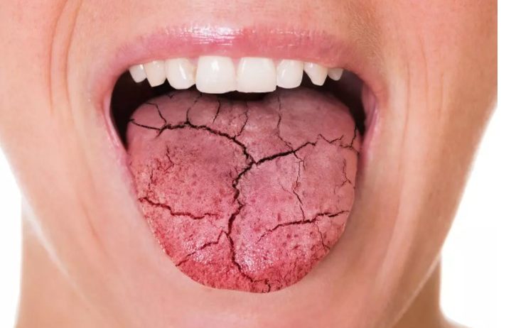 6 نصائح لتجنب جفاف الفم خلال صيام شهر رمضان