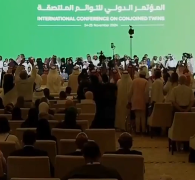 صورة تذكارية تاريخية للتوائم الملتصقة في السعودية