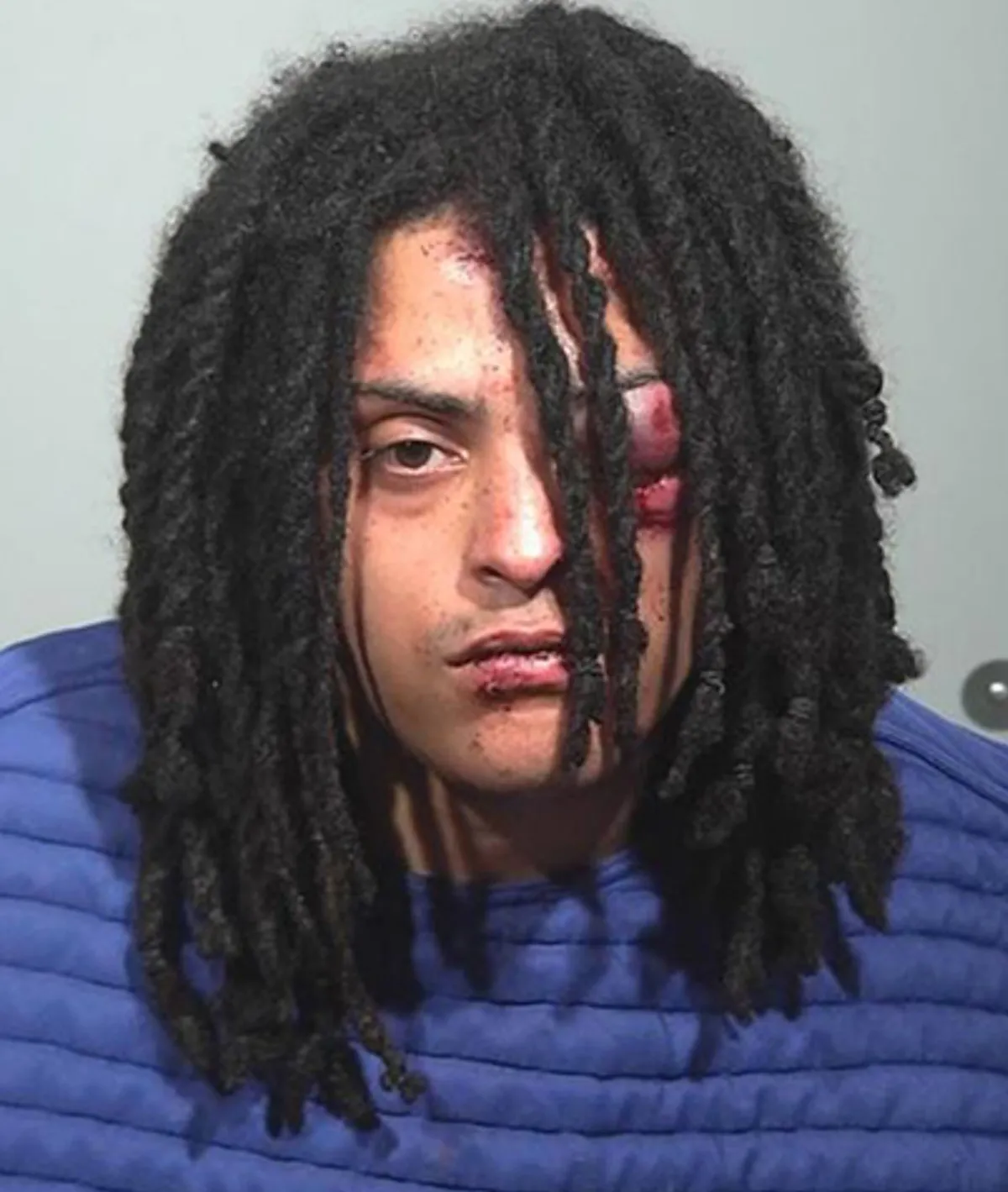 السعودية توزع مساعدات إيوائية جديدة في غزة