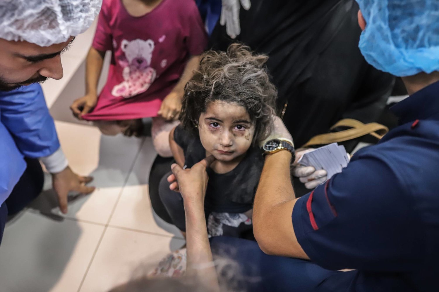 طفلة فلسطينية أصيبت جراء القصف الإسرائيلي على قطاع غزة